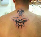tratamiento-para-eliminar-tatuajes eliminar tatuaje, quitar tatuaje permanente